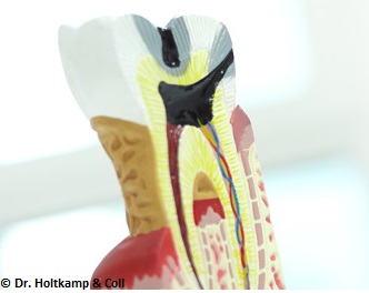 endodontie_dr-holtkamp Die Lebensdauer der Zähne verlängern 