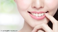 smilin_brücke-oder-implantat_pm2 Zu einem Lächeln ohne Lücke verhilft ein Implantat oder eine Brücke